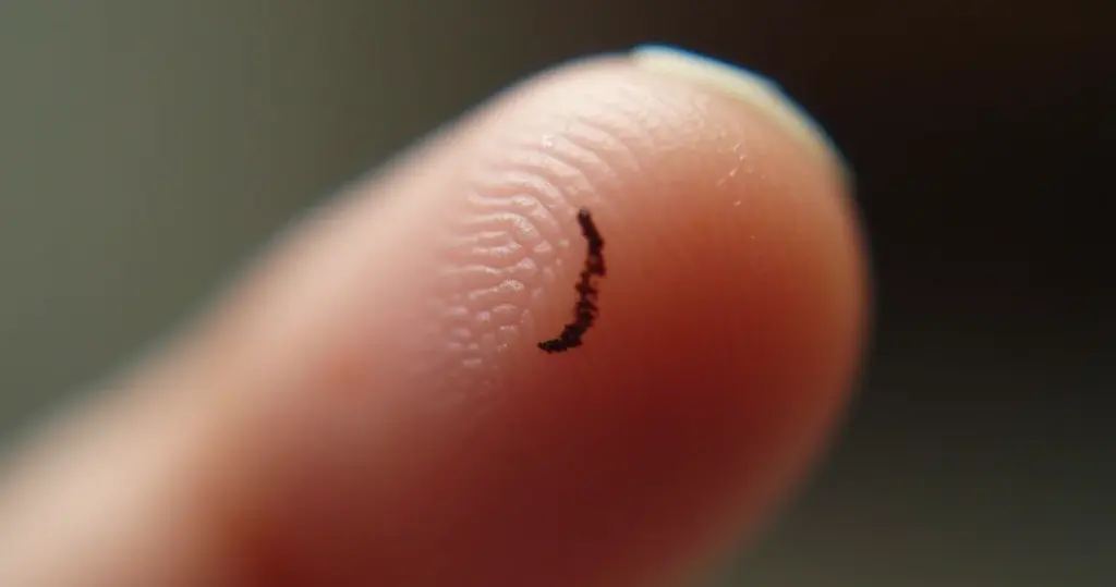 Linha Escura na Unha: Entenda os Sinais de Alerta Urgentes