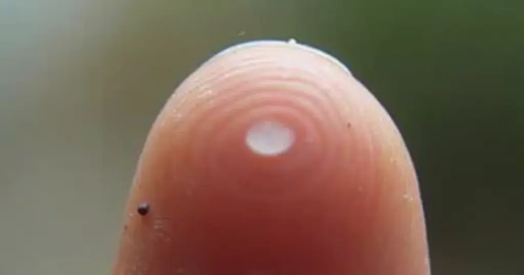 Mancha Branca na Unha: Falta de Vitamina ou Trauma? Descubra!