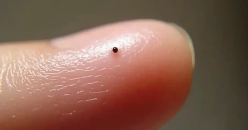 Mancha na Unha: O que revela sobre sua saúde? (Descubra)