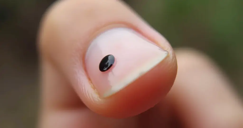 Pontinho Preto na Unha da Mão: Desvendamos o Que Seu Corpo Esconde