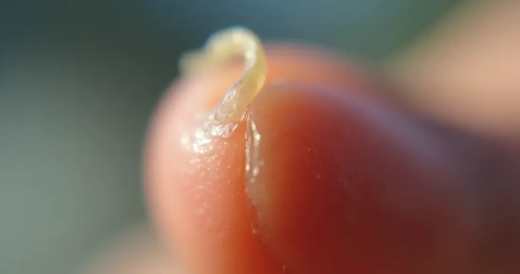 Unheiro na Unha da Mão: O Que Fazer em 2026? Unheiro na Unha da Mão: O Que Fazer em 2026?